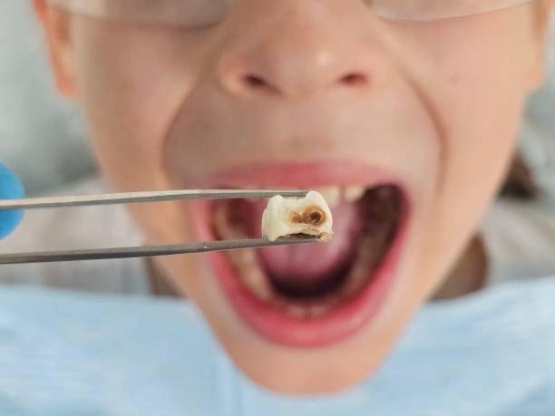 Best Emergency Dentist for Knocked-Out Tooth in Girardville, PA