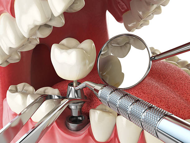 Best Emergency Dental Extractions in Girardville, PA